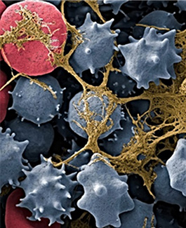 Close-up of platelets interacting in a blood sample under a microscope.