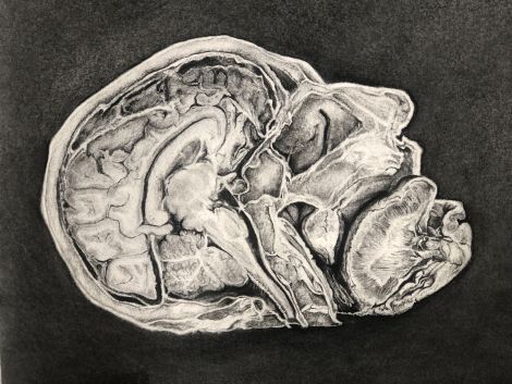 Sonya G Peters, Midsagittal Head,(detail) Charcoal on paper, 2019