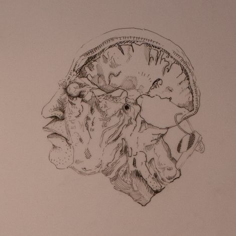 Jacques van der Merwe, Mid Sagittal Head II